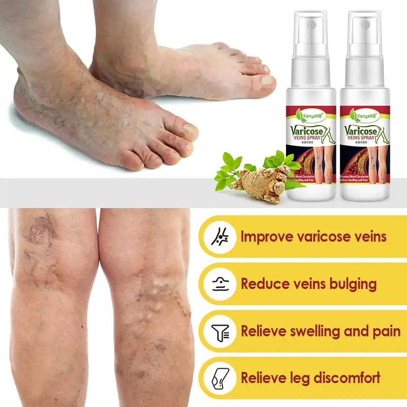 KanyeHB Vein Spray for Leg Care - 30ml