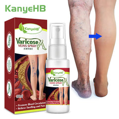 KanyeHB Vein Spray for Leg Care - 30ml